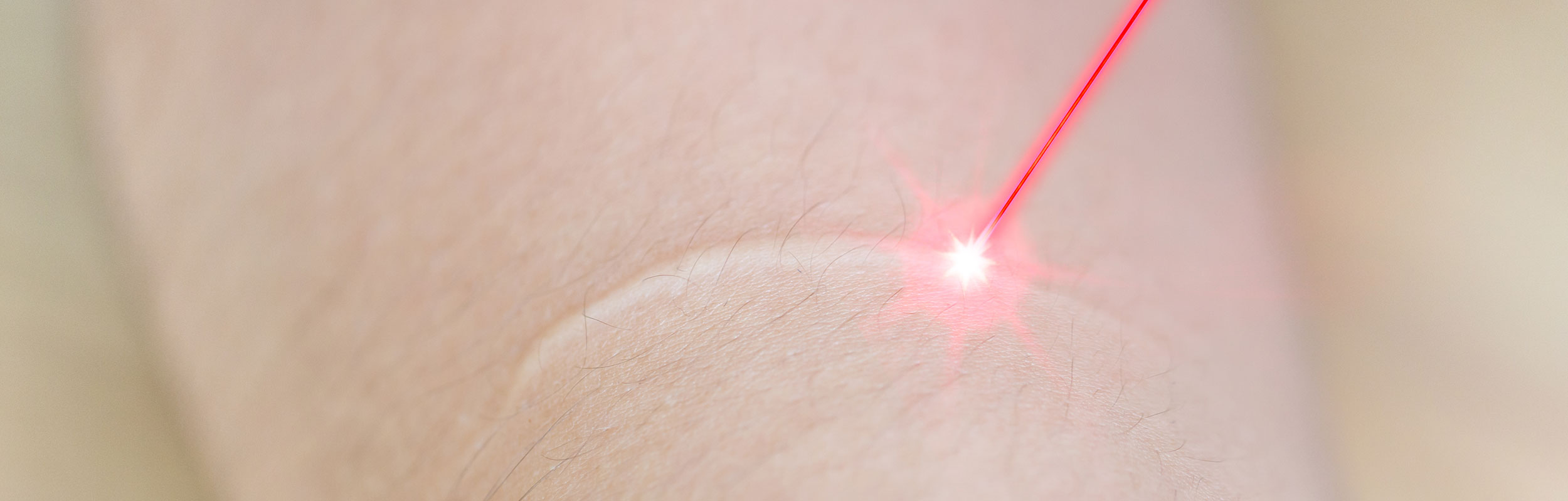 Traitement laser des cicatrices à Rouen - Dr Pellerin